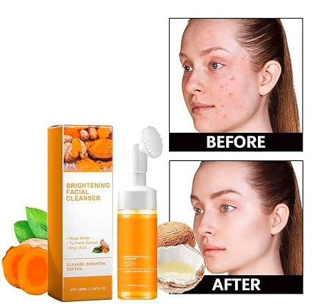 Turmeric 𝐊𝐨𝐣𝐢𝐜 Face Wash, Natural (Pack of - 1 ) 150 ML